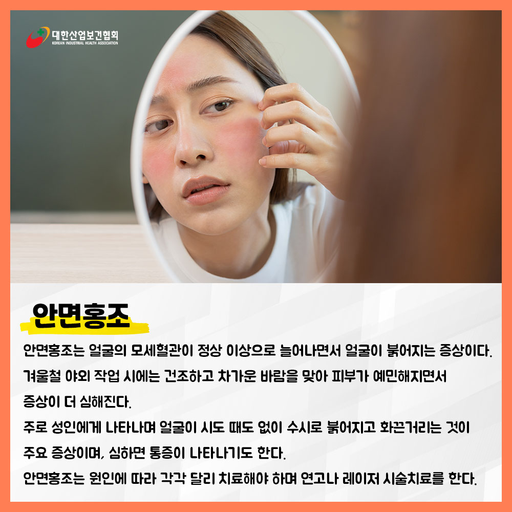 220217_sns_01