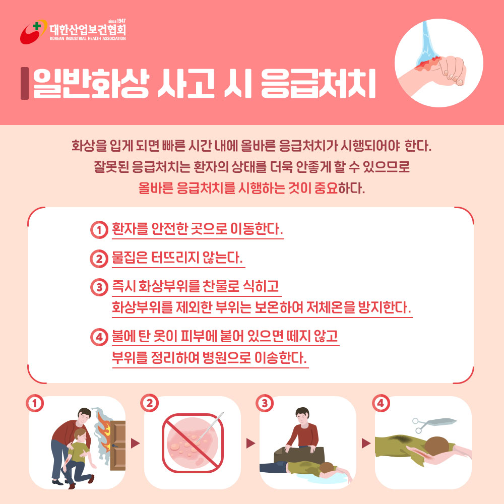 화상-응급처치3